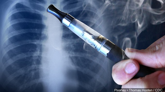 GetImage156 thumb - 【健康】電子たばこ関連の肺障害、ＣＤＣは原因解明で酢酸ビタミンＥに照準