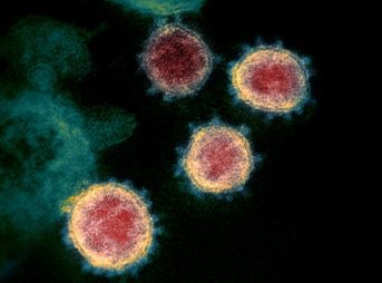 Novel Coronavirus SARS CoV 2RS 343x254 - 【西村担当相】「通勤電車で感染が広がったとの報告はないが、感染リスクが低い行動であっても制約を受ける段階にきた」 [ばーど★]